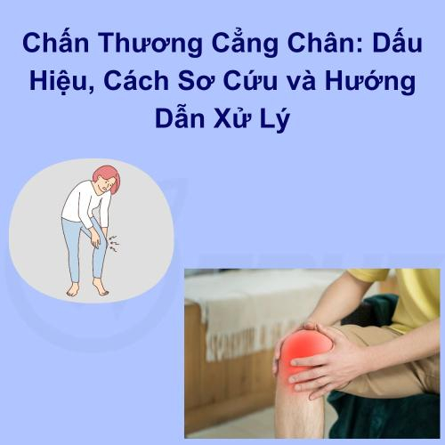 Chấn Thương Cẳng Chân: Dấu Hiệu, Cách Sơ Cứu và Hướng Dẫn Xử Lý